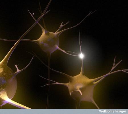 Alzheimer : un médicament pour réparer le cerveau