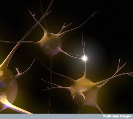 Alzheimer: A drug could repair damaged brain